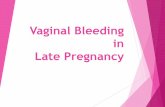 Vaginal Bleeding in Late Pregnancykho-health.mui.ac.ir/sites/kho-health.mui.ac.ir/files/kargah/allame... · Identify major causes of vaginal bleeding in the second half of pregnancy