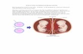 Twin to Twin Transfusion Syndrome (TTTS) · Twin to Twin Transfusion Syndrome ... is for the two different sperm to fertilize two ... the smaller twin (often called the donor twin)