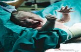 Article from Nursing for Women's Health, Volume 15 No. 4 ... · 34 weeks by CD and a significant increase in late preterm in-fants (34-36 completed weeks gestation) ... back form,