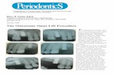 The Osteotome Sinus Lift Procedure - ProSites, Inc.c1-preview.prosites.com/44045/wy/docs/2009OCT.pdfThe Osteotome Sinus Lift ... the osteotomy from a crestal ... In the original technique