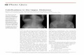 Calcifications in the Upper Abdomen · Calcifications in the Upper Abdomen JOHN R. McCONAGHY, MD, and RAMANA REDDY KANKANKALA, MBBS Department of Family Medicine, The …
