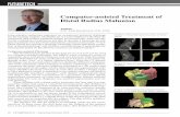 Computer-assisted Treatment of Distal Radius Malunion€¦ · Distal Radius Malunion Author: Prof. Filip Stockmans, M.D., Ph.D. Intra-articular malunions represent an exceptional