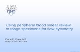 Using peripheral blood smear review to triage for … · neoplasms: • Distinguish ... Neff JL et al., Surgical Pathology 2013; 6:631639- ©2017 MFMER ... Using peripheral blood