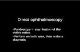 •Fundoscopy = examination of the visible retina …yazdani.co.uk/wp-content/uploads/2016/07/ophthalmoscopy.pdf · Direct ophthalmoscopy •Fundoscopy = examination of the visible