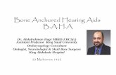 Bone Anchored Hearing Aids B.A.Hfac.ksu.edu.sa/sites/default/files/baha.pdf · – Infection/granulation ... • BAHA is excellent for bilateral conductive hearing loss with good
