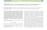 Case Report Acute ﬁbrinous and organizing … fibrinous and organizing... · Acute ﬁbrinous and organizing pneumonia in systemic lupus erythematosus: ... Other associations seen