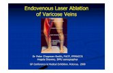 Endovenous Laser Ablation of Varicose Veins - GP … · Endovenous Laser Ablation of Varicose Veins Dr Peter Chapman-Smith, FACP, FFMACCS Angela Browne, DMU sonographer ... Pelvic
