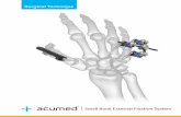 Surgical echnique - Acumed€¦ · External Fixation System. Part Number Part Description ... provided carbon rods or the threaded rods ... Acumed® Small Bone External Fixation System