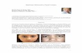Síndrome Obstructivo Nasal Crónico - clinicaborja.comclinicaborja.com/SindromeObstructivoNasalCronico.pdf · adiposo en los párpados inferiores, asas nasales anchas, atrofia de