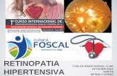 RETINOPATIA - Investigaciones Foscalinvestigacionesfoscal.com.co/archivos/material/25.pdf · RETINOPATÍA HIPERTENSIVA • Neovascularización retiniana • Secundaria a isquemia