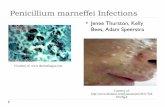 Penicillium marneffei Infections - …crcooper01.people.ysu.edu/Penicillium marneffei-v2-X11.pdf · Vanittanakom N, Cooper R, Fisher M, Sirisanthana T, Penicillium marneffei Vanittanakom