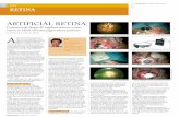 Commercial Argus II implant restores some vision in blind …escrs.org/publications/eurotimes/13Feb/ARTIFICIAL-RETINA.pdf · EUROTIMES | Volume 18 | Issue 2 A ll six blind retinitis