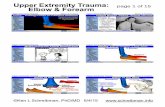 Upper Extremity Trauma: page 1 of 15 Elbow & …©Ken L Schreibman, PhD/MD 6/4/15 Upper Extremity Trauma: page 2 of 15 Elbow & Forearm Anatomy Radiographs FOPH BBFF Monteggia Galeazzi
