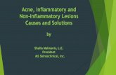 Acne, Inflammatory and Non-Inflammatory Lesions Causes and ... · (Exoderm) on facial wrinkles, acne scars and other skin problems of Asian patients. J. Dermatol. 34, 17 ...