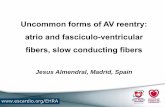 Uncommon forms of AV reentry: atrio and fasciculo ...assets.escardio.org/assets/Presentations/OTHER2011/EHRA-course-24... · Uncommon forms of AV reentry: atrio and fasciculo-ventricular
