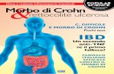 edition rettocolite ulcerosa - popsci.it · rettocolite ulcerosa Morbo di Crohn. 7. 8 clinical Shot la scienza in immagini Cellule dendritiche con ruoli distinti in colon e ileo colon