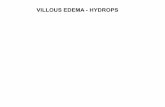 VILLOUS EDEMA - HYDROPS - Pathology · Villous Edema - Hydrops Villous edema is seen in association with numerous other placental pathologies: amniotic fluid infection, MVU, cytogenetic
