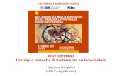 MAV cerebrali Principi e tecniche di trattamento endovascolare · MAV cerebrali Principi e tecniche di trattamento endovascolare Salvatore Mangiafico (AOU ... •The AVM is a complex