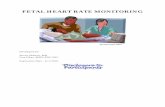 FETAL HEART RATE MONITORING - Mother Baby University · FETAL HEART RATE MONITORING Developed by - Stuart Shelton, MD Lisa Fikac, MSN, RNC-NIC Expiration Date - 6/1/2016 . This continuing