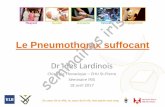 Le Pneumothorax suffocant seminaires 04 18 (2) (Dr I. Lardinois... · Au cœu de la ville, au cœu de la vie, met passie voor zorg Le Pneumothorax suffocant Dr Ines Lardinois Chirurgie