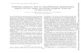Pubertas praecox to hypothalamic hamartoma: report two ... · mechanism whereby pubertas praecox is promoted by the tumour in question is debatable, the con-sequences of complete