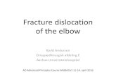Fracture dislocation of the elbow - ao-danmark.dkao-danmark.dk/wp-content/uploads/2016/04/Ti6KA.pdf · –Ved fraktur •Terrible Triad •Monteggia-fraktur •Sygehistorier •Konklusion