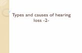 Types and causes of hearing loss -2- - مواقع ...fac.ksu.edu.sa/.../files/types_and_causes_of_hearing_loss_-2-.pdf · SNHL •Refers to hearing loss resulted from the damage of