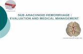 m.blog.daum.net SUB ARACHNOID HEMORRHAGE : EVALUATION AND MEDICAL ...aiimsnets.org/specialities/vascular/Sub-Arachnoid Hemorrhage... · CT scan should be performed before LP to exclude