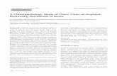 A Clinicopathologic Study of Thirty Cases of Acquired Perforating … · 2014-05-21 · nary aspergillosis11, neurodermatitis5, atopic dermatitis12, scabies13, and pregnancy14. To