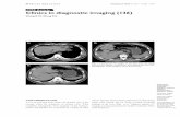 CME Article Clinics in diagnostic imaging (136) · urology clinic for symptoms of urinary colic. Plain computed tomography (CT) imaging of the kidneys, ureters and bladder was requested