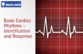 Basic Cardiac Rhythms – Identification and Response EKG Refresher.pdf · Interpreting EKG Rhythm Strips Step 1 – Heart Rate Methods to determine heart rate The 6 second method