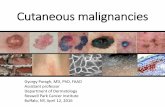 Cutaneous malignancies · Non-melanoma Skin Cancers Includes basal cell carcinomas (BCC) & squamous cell carcinomas (SCC) Most common malignancies in humans 5.4 million cases annually
