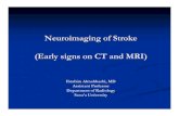 Neuroimaging of Stroke (Early signs on CT and MRI)yns-yemen.com/NewWebSite2/neuroimaging conference.pdf · Neuroimaging of Stroke (Early signs on CT and MRI) Ibrahim Almahbashi, MD
