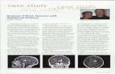case study - ENCOGNITIVE.COM study-- Reversal of Brain Tumours... · case study Reversal of Brain Tumours with Nutritional Protocol ... "BioBran is used to stimulate the immune system