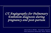 CT Angiography for Pulmonary Embolism … Angiography for Pulmonary Embolism diagnosis during pregnancy and post-partum Marie-Pierre REVEL- Pompidou Hospital, Paris Descartes University,