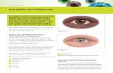 pterygium and pinguecula - Retina Consultants of WNY · EYE FACTS pterygium and pinguecula Pterygium (pronounced tur-IJ-ee-um) and pinguecula (pronounced pin-GWEK-yoo-la) are growths