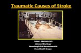 Traumatic Causes of Stroke - PeaceHealth · Traumatic Causes of Stroke Elaine J. Skalabrin MD . Vascular Neurology . Neurohospitalist-Neurointensivist . PeaceHealth Oregon