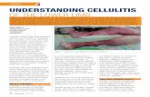 Review Review UNDERSTANDING CELLULITIS OF THE .Review Review Patients with leg ulceration are at