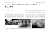 Root Resorption due to Dental Trauma - EndoExperience resorption due to dental trauma... · Root resorption due to dental trauma flammatory response over the entire root surface,