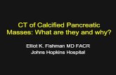 CT of Calcified Pancreatic Masses: What are … of Calcified Pancreatic Masses: What are they and why? Elliot K. Fishman MD FACR Johns Hopkins Hospital Calcifications in Pancreatic