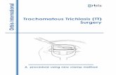 Trachomatous Trichiasis (TT) Surgery Orbis Introduction This manual is designed to show a technique for trachomatous trichiasis (TT) surgery using a clamp that protects the cornea,