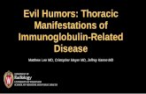Evil Humors: Thoracic Manifestations of Immunoglobulin ... · • Types: IgA, IgD (uncertain function), IgE, IgG, IgM ... Figure: Chronic eosinophilic pneumonia in a patient with