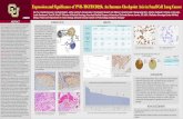Expression and Significance of PVR-TIGIT/CD226, An Immune ... · TIGIT positive staining in tonsil . CD226 positive staining in tonsil TIGIT positive staining in SCLC by red, the