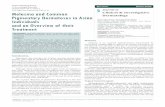 Melasma and Common Pigmentary Dermatoses in Asian ... · Citation: Kwon SH, Park KC. Melasma and Common Pigmentary Dermatoses in Asian Individuals and an Overview of their Treatment.