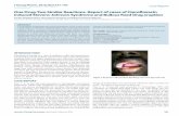 One Drug-Two Similar Reactions. Report of ... · Sequelae Post inflammatory hyperpigmentation Ocular: Symphblepharon, trichiasis, xerosis Figure 2: Bullous fixed drug eruption seen