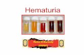 Hematuria - cairopedneph.comcairopedneph.com/document/hematuria.pdf · Macroscopic(gross) Hematuria (visible red urine) MicroscopicHematuria >3RBCs/HPF from 2 of 3 urinary sediments
