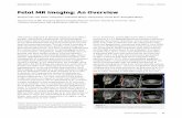Fetal MR Imaging: An Overview - clinical-mri.comclinical-mri.com/wp-content/uploads/2018/12/Wang_Fetal_MRI_MAGNETOM... · 1Department of MR, Shandong Medical Imaging Research Institute,