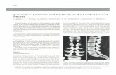 Correlative Anatomic and CT Study of the Lumbar Lateral Recess · back pain and sciatica. CT is noninvasive and usually can detect a CT is noninvasive and usually can detect a disk