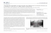Antegrade Flexible Ureteroscopy for Bilateral Ureteral ... · Bum Soo Kim, Jun Nyung Lee, Jae Young Choi, Yoon Kyu Park, Tae-Hwan Kim Department of Urology, Kyungpook National University