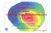 Keratectasia After Laser in Situ Keratomileusis ( LASIK)dr-karimian.com/images/pdf/cong2006/Keratectasia2006.pdf · Keratectasia After Laser in Situ Keratomileusis ( LASIK) Farid